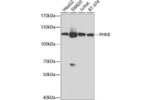 Western blot analysis of extracts of various cell lines using PHKB Polyclonal Antibody at dilution of 1:1000. (PHKB anticorps)