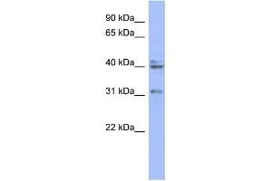 WB Suggested Anti-PABPN1 Antibody Titration: 0. (PABPN1 anticorps  (N-Term))