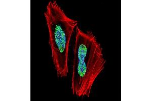 Fluorescent confocal image of  cell stained with RBPJ Antibody (N-term) (ABIN1538823 and ABIN2849020). (RBPJ anticorps  (N-Term))