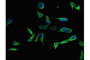 Immunofluorescent analysis of Hela cells using ABIN7151432 at dilution of 1:100 and Alexa Fluor 488-congugated AffiniPure Goat Anti-Rabbit IgG(H+L)