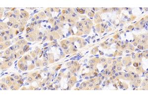 Detection of TLR5 in Human Stomach Tissue using Polyclonal Antibody to Toll Like Receptor 5 (TLR5)