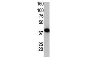 Western blot using SUMO2 antibody and GST-SUMO2 fusion protein.