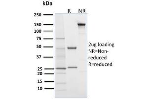 SDS-PAGE Analysis Purified Desmoglein-1 Mouse Monoclonal Antibody (32-2B).