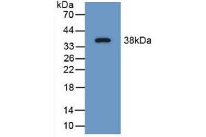 Detection of Recombinant SYN1, Mouse using Polyclonal Antibody to Synapsin I (SYN1) (SYN1 anticorps  (AA 113-420))