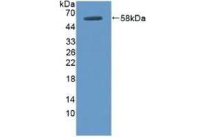 Detection of Recombinant DOK3, Human using Polyclonal Antibody to Docking Protein 3 (DOK3) (DOK3 anticorps  (AA 128-385))