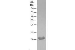 Western Blotting (WB) image for Interleukin 8 (IL8) (AA 28-99) (Active) protein (His tag) (ABIN7123620)