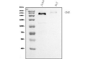Western blot analysis of CD45 using anti-CD45 antibody (ABIN7602776).