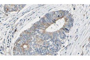 anti-Dynactin 2 (p50) (DCTN2) (C-Term) antibody