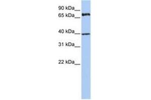 Image no. 1 for anti-Membrane Protein, Palmitoylated 5 (MAGUK P55 Subfamily Member 5) (MPP5) (AA 36-85) antibody (ABIN6740785) (MPP5 anticorps  (AA 36-85))