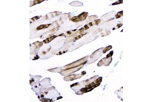 IHC analysis of ACTN3 using anti-ACTN3 antibody (ABIN6719273).