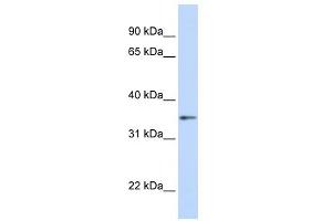 GNB1 antibody used at 1 ug/ml to detect target protein. (GNB1 anticorps)