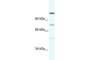 WB Suggested Anti-D930005D10RIK Antibody Titration:  5. (Radil anticorps  (C-Term))