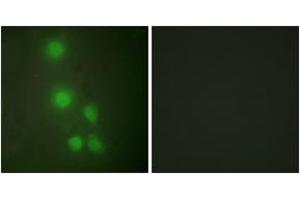 Immunofluorescence analysis of HuvEc cells, using ACTL6A Antibody. (BAF53A anticorps  (AA 201-250))