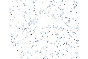Immunocytochemistry (ICC) image for anti-Achaete-Scute Complex Homolog 1 (Drosophila) (ASCL1) (AA 186-236) antibody (ABIN7455113) (Recombinant ASCL1 anticorps  (AA 186-236))