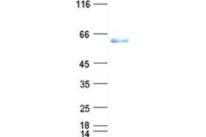 Validation with Western Blot