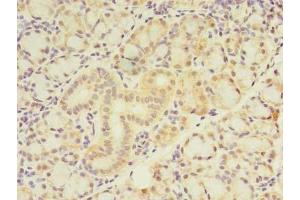 Immunohistochemistry of paraffin-embedded human pancreatic tissue using ABIN7175970 at dilution of 1:100 (ZNF238 anticorps  (AA 62-364))
