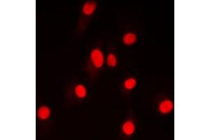 Immunofluorescent analysis of DNA Ligase 4 staining in HepG2 cells. (LIG4 anticorps  (Center))