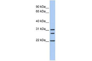 WB Suggested Anti-CNN1 Antibody Titration:  0. (CNN1 anticorps  (N-Term))