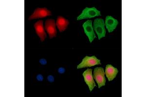 ABIN7095276 and ABIN7099333 staining HepG2 cells by IF/ICC.