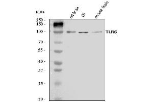 Western blot analysis of Tlr6 using anti-Tlr6 antibody (ABIN7602233).