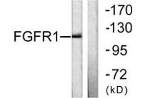 Western blot analysis of extracts from 293 cells, using FGFR1 (Ab-654) Antibody. (FGFR1 anticorps  (AA 626-675))