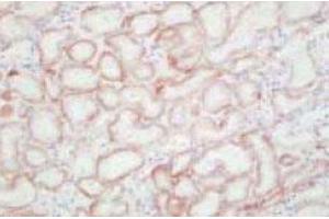 Imunohistochemical analysis of human kidney tissue, using SLC22A6 polyclonal antibody  .