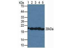 Western blot analysis of (1) Human Serum, (2) Porcine Liver Tissue, (3) Human HeLa cells, (4) Porcine Brain Tissue and (5) Human MCF-7 Cells. (SOD2 anticorps  (AA 25-222))
