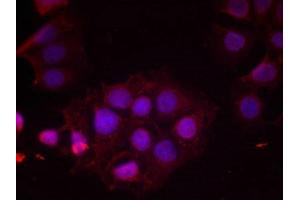 Immunofluorescence staining of methanol-fixed MCF cells using Estrogen Receptor-a(Phospho-Ser118) Antibody. (Estrogen Receptor alpha anticorps  (pSer118))
