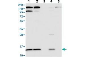 Western blot analysis of Lane 1: RT-4, Lane 2: U-251 MG, Lane 3: Human Plasma, Lane 4: Liver, Lane 5: Tonsil with CMC1 polyclonal antibody . (CMC1 anticorps)
