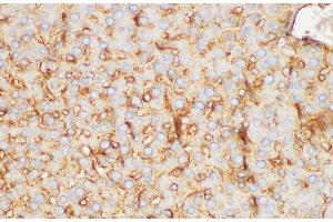 Immunohistochemistry of paraffin-embedded Rat liver using FGB Polycloanl Antibody at dilution of 1:200