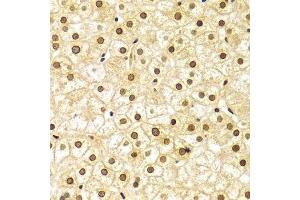 Immunohistochemistry of paraffin-embedded Human liver injury using Lamin A/C antibody.