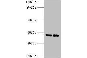 Western blot All lanes: SRM antibody at 2 μg/mL Lane 1: EC109 whole cell lysate Lane 2: 293T whole cell lysate Secondary Goat polyclonal to rabbit IgG at 1/15000 dilution Predicted band size: 34 kDa Observed band size: 34 kDa (Spermidine Synthase anticorps  (AA 17-302))