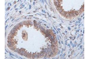Immunohistochemical staining of formalin-fixed paraffin-embedded human fetal kidney tissue showing cytoplasmic staining with ECH1 polyclonal antibody  at 1 : 100 dilution. (ECH1 anticorps  (AA 145-325))