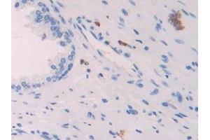 Detection of PF4 in Human Prostate Tissue using Polyclonal Antibody to Platelet Factor 4 (PF4) (PF4 anticorps  (AA 31-101))