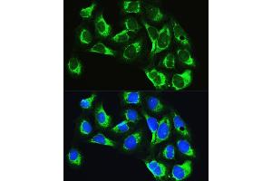 Immunofluorescence analysis of U2OS cells using LARS Rabbit pAb (ABIN7268238) at dilution of 1:100.