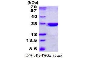Image no. 1 for Nonhomologous End-Joining Factor 1 (NHEJ1) protein (His tag) (ABIN6387017)