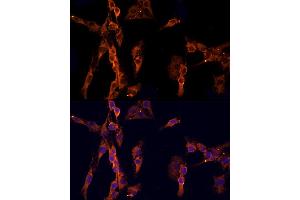 Immunofluorescence analysis of C6 cells using EPS15 Rabbit pAb  at dilution of 1:200 (40x lens). (EPS15 anticorps  (AA 660-840))