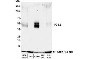 Western Blotting (WB) image for anti-Programmed Cell Death 1 Ligand 2 (PDCD1LG2) (AA 20-220) antibody (ABIN7795676)