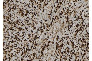 ABIN6277748 at 1/100 staining Human gastric tissue by IHC-P. (MCM5 anticorps  (N-Term))