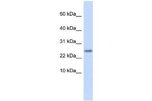 Cystatin 9 antibody used at 1 ug/ml to detect target protein. (CST9 anticorps)