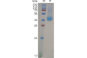 Human CD23 Protein, His Tag on SDS-PAGE under reducing condition.