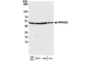 Western Blotting (WB) image for anti-Protein Phosphatase 4, Regulatory Subunit 2 (PPP4R2) (C-Term) antibody (ABIN7453641)