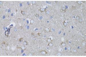 Immunohistochemistry of paraffin-embedded Rat brain using MYH10 Polyclonal Antibody at dilution of 1:100 (40x lens). (MYH10 anticorps)