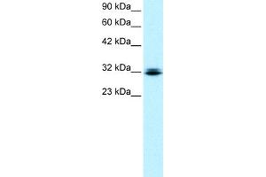 WB Suggested Anti-RAX Antibody Titration:  0. (RAX anticorps  (N-Term))
