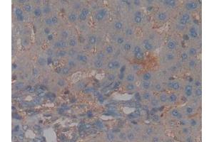 Detection of CFH in Rat Liver Tissue using Polyclonal Antibody to Complement Factor H (CFH) (Complement Factor H anticorps  (AA 975-1217))