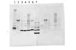 Western Blotting (WB) image for anti-Desmoplakin (DSP) antibody (ABIN1742177) (Desmoplakin anticorps)