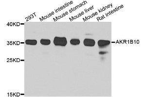 Western blot analysis of extracts of various cell lines, using AKR1B10 antibody. (AKR1B10 anticorps  (AA 1-316))