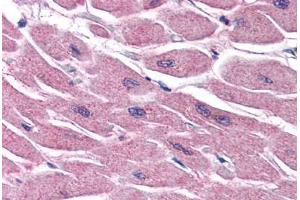 Human Heart (formalin-fixed, paraffin-embedded) stained with STRADB antibody ABIN351469 at 3. (STRADB anticorps  (AA 406-418))