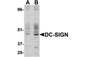 Western Blotting (WB) image for anti-CD209 (CD209) (C-Term) antibody (ABIN1030357) (DC-SIGN/CD209 anticorps  (C-Term))