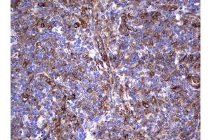 Image no. 16 for anti-Tumor Necrosis Factor Receptor Superfamily, Member 8 (TNFRSF8) (AA 19-379) antibody (ABIN1491084)